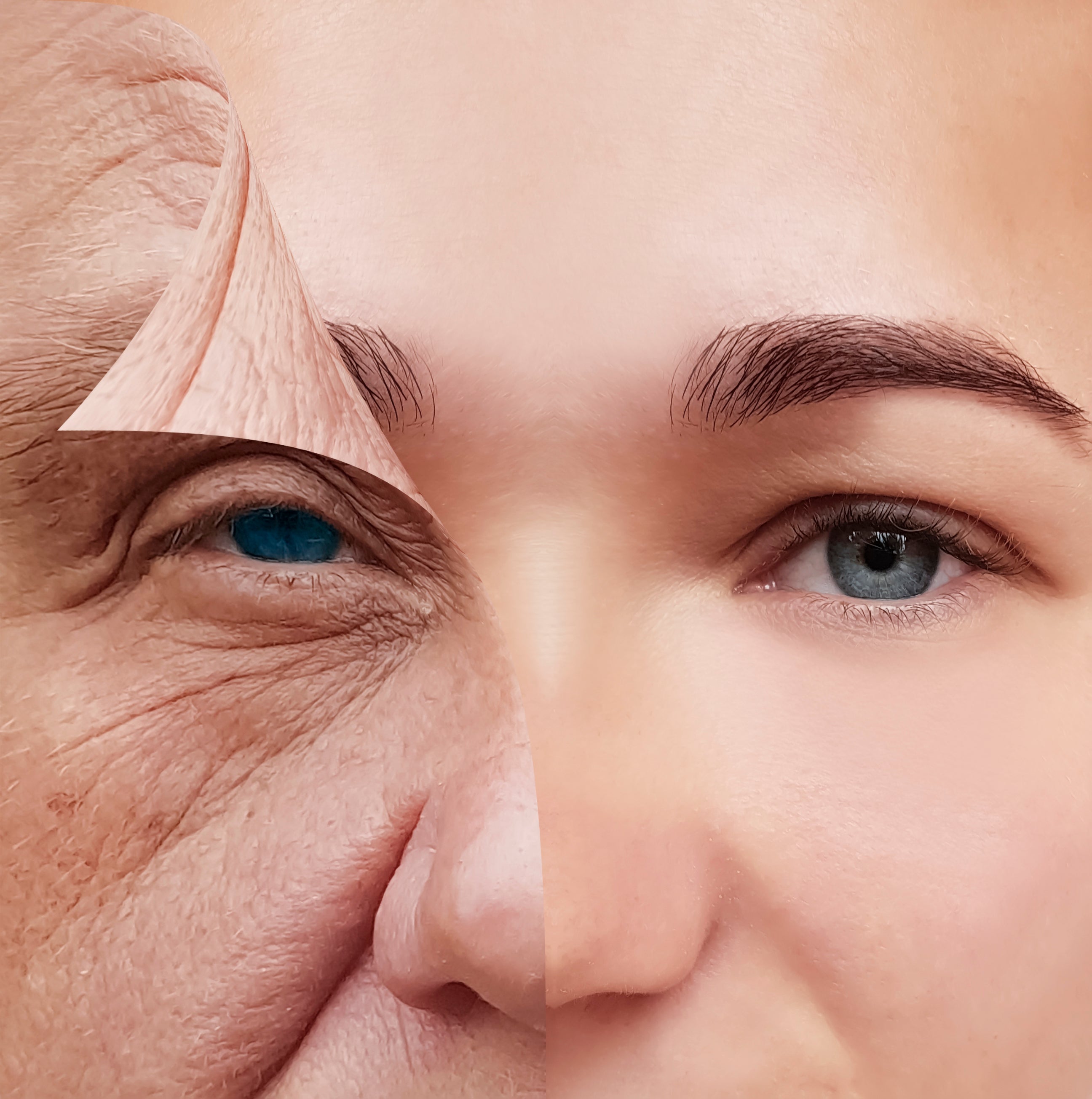 Skin Barrier- maintaining a healthy one